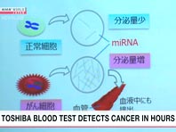 Японцы научились диагностировать рак всего за пару часов - «Новости»