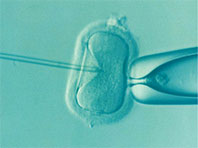 Популярность ЭКО грозит настоящей эпидемией бесплодия - «Новости»