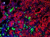 Обнаружена новая мишень для терапии самых агрессивных опухолей - «Новости»