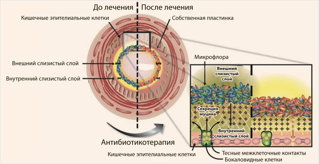 Современные подходы к профилактике и регидратационной терапии антибиотик-ассоциированной диареи у детей на фоне ОРИ - «Гастроэнтерология»