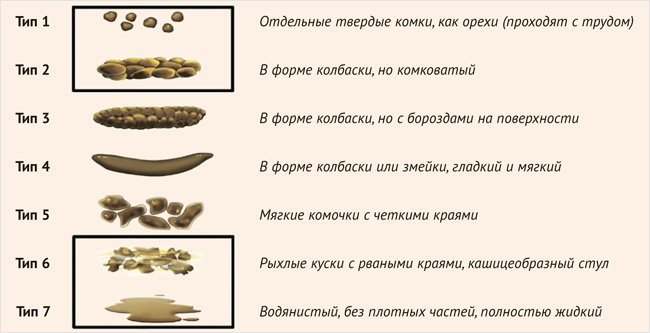 Современные аспекты ведения пациентов с синдромом раздраженного кишечника - «Гастроэнтерология»