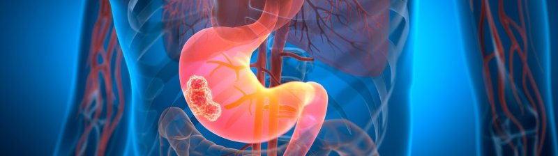 Трифлуридин + [типирацил] одобрен для применения в России по трем показаниям - «Новости Медицины»