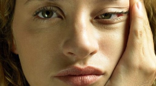 Врач подсказал, о чем говорит чрезмерная отечность - «Дерматология»