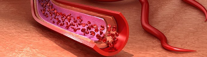 Экспертный совет принял в перечни фонда «Круг добра» новый препарат от бета‑талассемии - «Новости Медицины»