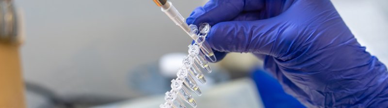 Новый тест для быстрого выявления возбудителей шигиллеза разработан учеными Роспотребнадзора - «Новости Медицины»