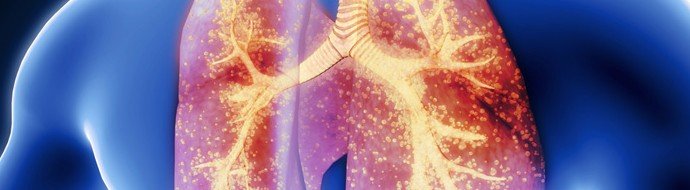 Только 9% взрослых привиты от пневмококка: врачи призывают усилить профилактику пневмонии - «Новости Медицины»